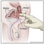 acupuncture_nyc_digital_rectal_exam_prostate_anatomy Digital Rectal Exam